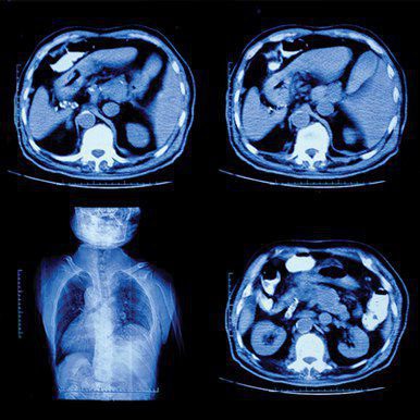 UCSF Abdominal and Thoracic Imaging 2022 ( VIDEOS) UCSF Abdominal and Thoracic Imaging 2022 ( VIDEOS)