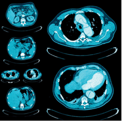 UCSF Abdominal and Thoracic Imaging 2025