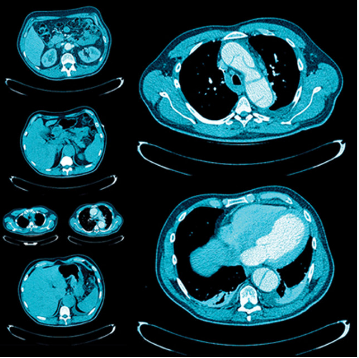 UCSF Abdominal and Thoracic Imaging 2025 UCSF Abdominal and Thoracic Imaging 2025