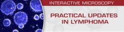 USCAP Practical Updates in Lymphoma 2018