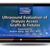 Ultrasound Evaluation of Dialysis Access Grafts and Fistula Ultrasound Evaluation of Dialysis Access Grafts and Fistula