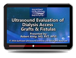 Ultrasound Evaluation of Dialysis Access Grafts and Fistula