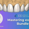 Mastering Exocad Bundle (3 Courses)