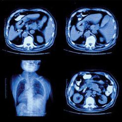 UCSF Radiology Clinical Update 2023