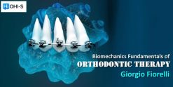 OHI-S Biomechanics Fundamentals of Orthodontic Therapy – Giorgio Fiorelli