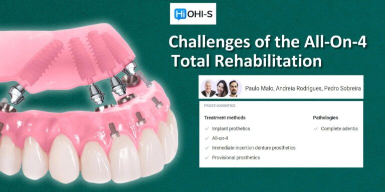 OHI-S Сhallenges of the All-On-4 Total Rehabilitation OHI-S Сhallenges of the All-On-4 Total Rehabilitation
