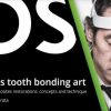 Hirata’s Tooth Bonding Art – Adhesive Composite Restorations: Concept and Technique (Audio Portuguese with English subtitles) Hirata’s Tooth Bonding Art – Adhesive Composite Restorations: Concept and Technique (Audio Portuguese with English subtitles)