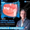 OHI-S Veneers, inlay, onlay, crowns: full protocols OHI-S Veneers, inlay, onlay, crowns: full protocols