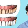 OHI-S The Complete Guide To Digital Dentistry OHI-S The Complete Guide To Digital Dentistry