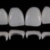 Gidedental Prosthetic Rehabilitation on Natural Teeth – Predictable, Esthetic and Systematic Steps 2020 Gidedental Prosthetic Rehabilitation on Natural Teeth – Predictable, Esthetic and Systematic Steps 2020