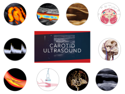 123Sonography Carotid Ultrasound MasterClass