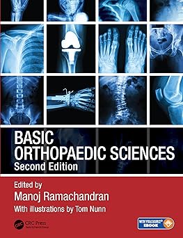 Basic Orthopaedic Sciences, The Stanmore Guide, 2nd Edition Basic Orthopaedic Sciences, The Stanmore Guide, 2nd Edition