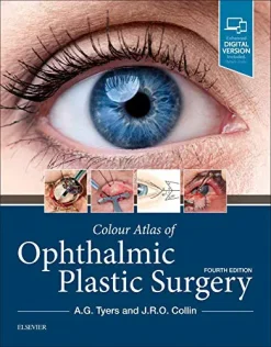 Colour Atlas of Ophthalmic Plastic Surgery, 4th Edition (Videos)