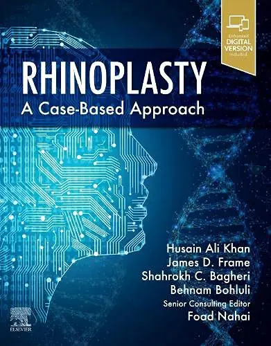 Rhinoplasty: a Case-based approach (Original PDF from Publisher) Rhinoplasty: a Case-based approach (Original PDF from Publisher)