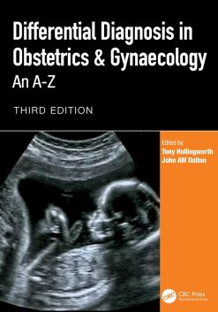 Differential Diagnosis in Obstetrics & Gynaecology: An A-Z, 3rd Edition (EPUB and pdf)