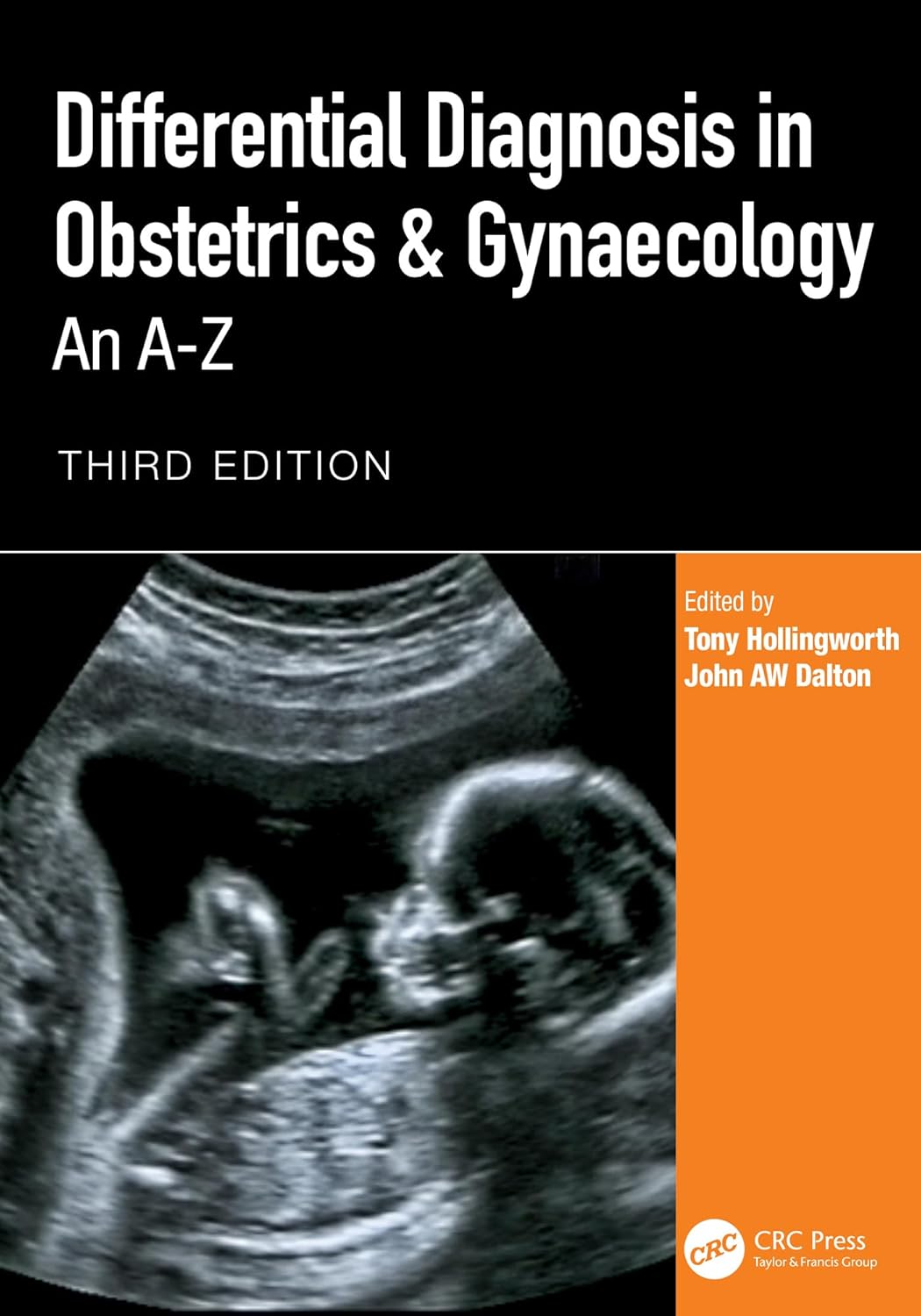 Differential Diagnosis in Obstetrics & Gynaecology: An A-Z, 3rd Edition (EPUB and pdf) Differential Diagnosis in Obstetrics & Gynaecology: An A-Z, 3rd Edition (EPUB and pdf)