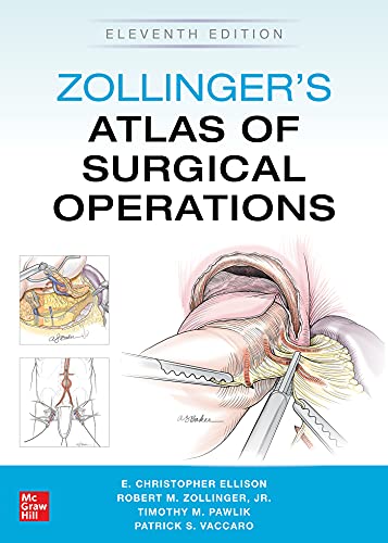 Zollinger’s Atlas of Surgical Operations, Eleventh Edition (True PDF) Zollinger’s Atlas of Surgical Operations, Eleventh Edition (True PDF)