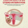Transplante de Útero Intervivos: A (im)Possibilidade de Realização da Conduta à Luz da Perspectiva Biojurídica (Portuguese Edition) (EPUB and pdf) Transplante de Útero Intervivos: A (im)Possibilidade de Realização da Conduta à Luz da Perspectiva Biojurídica (Portuguese Edition) (EPUB and pdf)