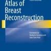 Atlas of Breast Reconstruction(Publisher PDF) Atlas of Breast Reconstruction(Publisher PDF)