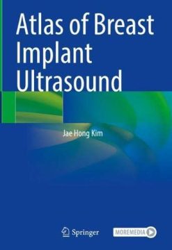 Atlas of Breast Implant Ultrasound (Original PDF from Publisher)