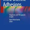 Intra Uterine Adhesions: Diagnostic and Therapeutic Insight (Original PDF from Publisher)