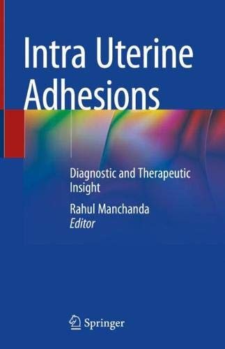 Intra Uterine Adhesions: Diagnostic and Therapeutic Insight (Original PDF from Publisher) Intra Uterine Adhesions: Diagnostic and Therapeutic Insight (Original PDF from Publisher)