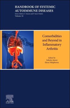 Inflammatory Arthritis Beyond the Joints