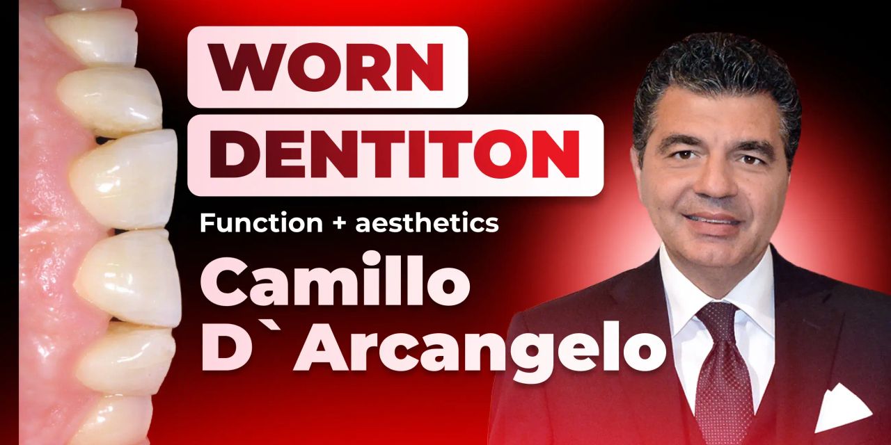 OHI-S Treatment of pathological tooth wear. Additive prosthodontics. The concept Aesthetics-Function-Posture OHI-S Treatment of pathological tooth wear. Additive prosthodontics. The concept Aesthetics-Function-Posture 10 lession 19h36m