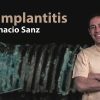 Osteocom Peri-implantitis by Ignacio Sanz Spanish Osteocom Peri-implantitis by Ignacio Sanz