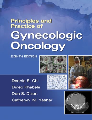 Principles and Practice of Gynecologic Oncology, 8th Edition (EPUB and pdf) Principles and Practice of Gynecologic Oncology, 8th Edition (EPUB)