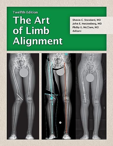 The Art of Limb Alignment, 12th edition (Original PDF from Publisher) The Art of Limb Alignment, 12th edition (Original PDF from Publisher)