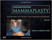 Augmentation Mammaplasty: Redefining the Patient and Surgeon Experience (Original PDF from Publisher)