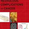 Neurologic Complications of Cancer (Contemporary Neurology Series Book 73), 2nd edition (Original PDF from Publisher) Neurologic Complications of Cancer (Contemporary Neurology Series Book 73), 2nd edition (Original PDF from Publisher)