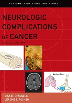 Neurologic Complications of Cancer (Contemporary Neurology Series Book 73), 2nd edition (Original PDF from Publisher)
