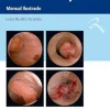 Histeroscopia: Manual Ilustrado (Portuguese Edition) (EPUB and pdf) Histeroscopia: Manual Ilustrado (Portuguese Edition) (EPUB and pdf)