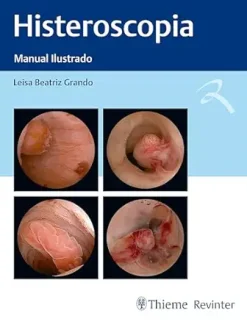 Histeroscopia: Manual Ilustrado (Portuguese Edition) (EPUB and pdf)