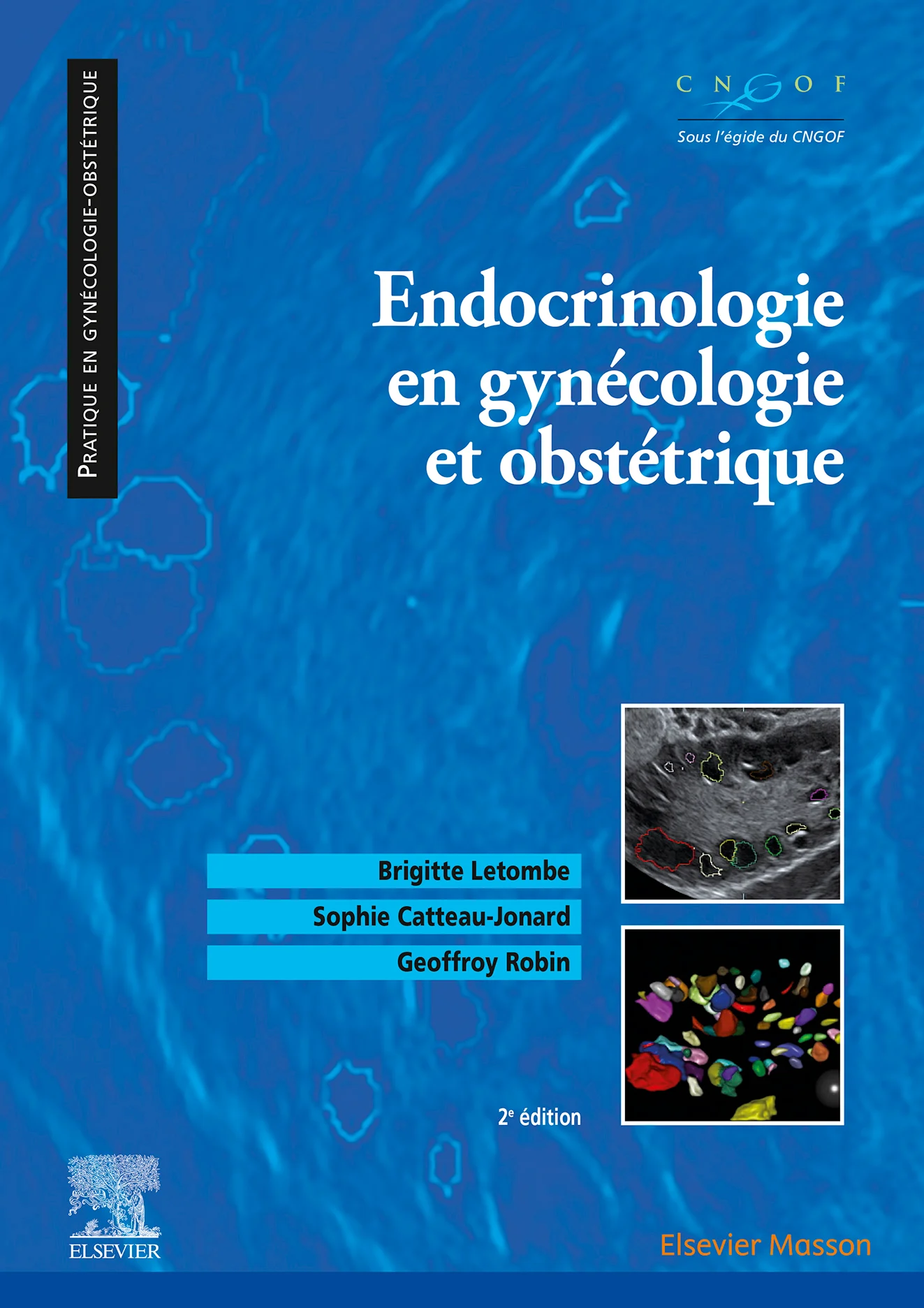 Endocrinologie en gynécologie et obstétrique, 2nd Edition (EPUB and pdf) Endocrinologie en gynécologie et obstétrique, 2nd Edition (EPUB and pdf)