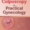 Colposcopy in Practical Gynecology (EPUB and pdf)