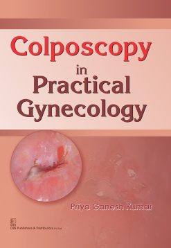 Colposcopy in Practical Gynecology (EPUB and pdf)