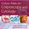 Colour Atlas on Colposcpoy and Cytology (Original PDF from Publisher) Colour Atlas on Colposcpoy and Cytology (Original PDF from Publisher)