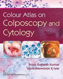 Colour Atlas on Colposcpoy and Cytology (Original PDF from Publisher)