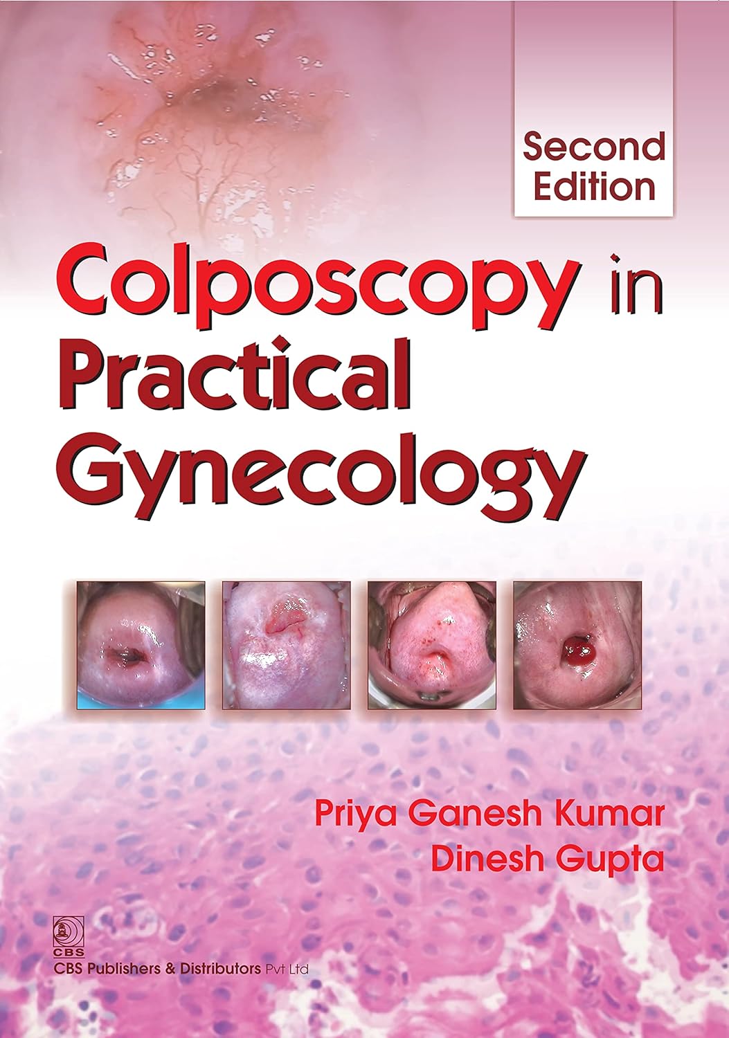 Colposcopy in Practical Gynaecology (Original PDF from Publisher) Colposcopy in Practical Gynaecology (Original PDF from Publisher)