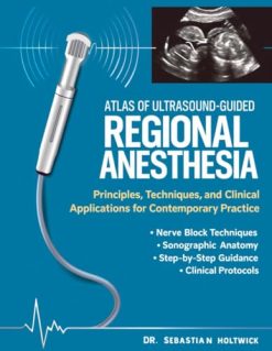 Atlas of Ultrasound-Guided Regional Anesthesia