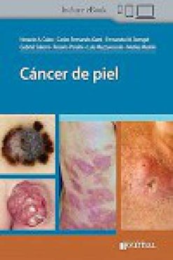 Cáncer de piel (Original PDF from Publisher)