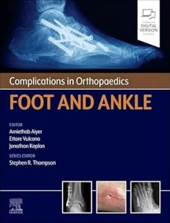 Complications in Orthopaedics: Foot and Ankle (EPUB)