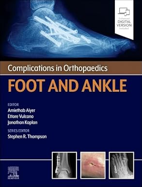Complications in Orthopaedics: Foot and Ankle (EPUB and pdf) Complications in Orthopaedics: Foot and Ankle (EPUB)