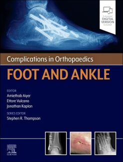 Complications in Orthopaedics: Foot and Ankle (True PDF)