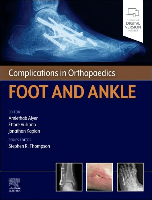 Complications in Orthopaedics: Foot and Ankle (True PDF) Complications in Orthopaedics: Foot and Ankle (True PDF)