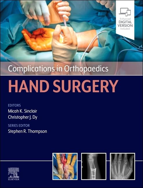 Complications in Orthopaedics: Hand Surgery (Original PDF from Publisher) Complications in Orthopaedics Hand Surgery (Original PDF from Publisher)