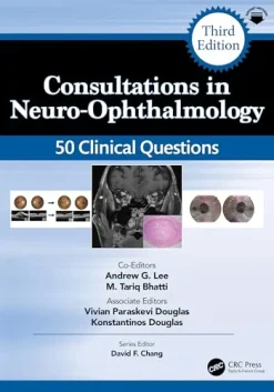 Consultations in Neuro Ophthalmology 50 Clinical Questions, 3rd edition (Original PDF from Publisher)
